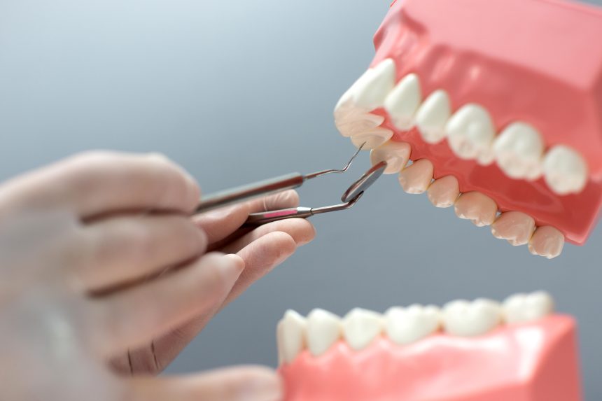 The Future of Dental Implants